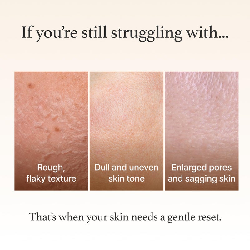 I'm from Rice Mask 3.88 Oz, Gentle Exfoliating Wash Off Facial Mask for Dull, Rough Skin, Pore Clearing, Remove Dead Skin Cells, Uneven Skin Tone, Smooth Skin, Moiustirinzg, Radiant - Image 3