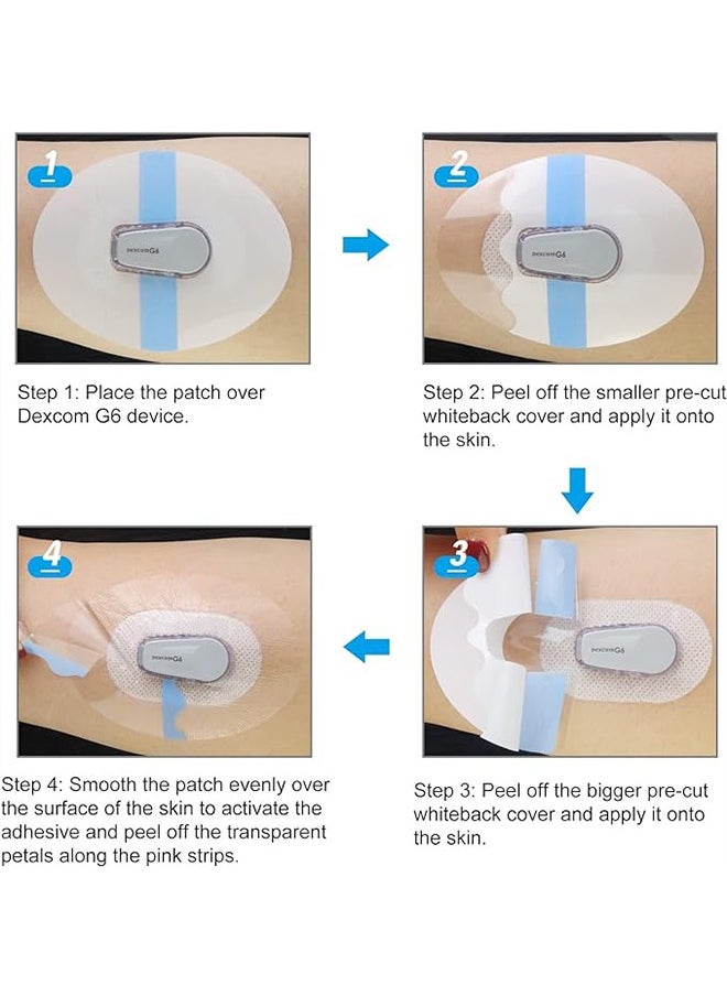 20 Piece Adhesive Patches for CGM Dexcom G6 Sensor Covers Overpatch Waterproof Sticker Clear Film Tape, Sport Sensor Covers Patches, Blue