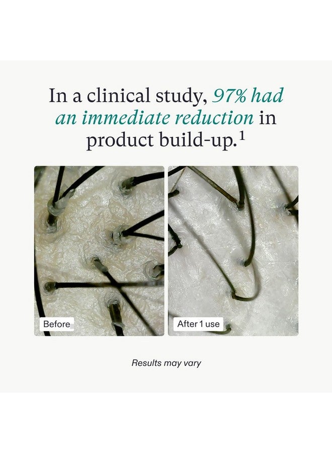 نوترافول قناع تقشير فروة الرأس من نوترافول، يزيل تراكم المنتجات والزيوت لشعر وفروة رأس أكثر صحة، تركيبة طبية للشعر الخفيف، آمن على اللون والتمديد - زجاجة 4 أونصة سائلة - Image 4