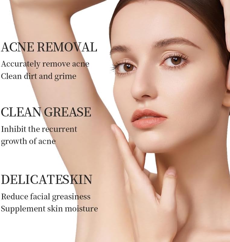 Kormesic 20% Azelaic Acid Acne Cream 2PCS- Prevents Breakouts, Soothes Irritation & Moisturizes Oily  Skin - Image 2