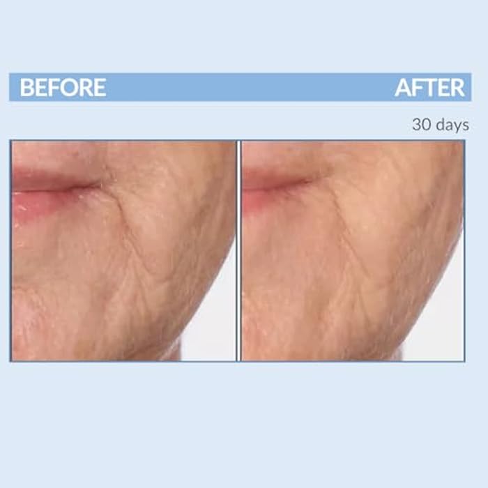 Serious Skincare Vitamin A Force XR Retinol Face Serum Concentrate, Micro Exfoliate & Resurface for Radiant Skin, for Lines, Wrinkles, Pore Minimizer, Anti-Aging 1 Oz. (Pack of 2) - Image 4