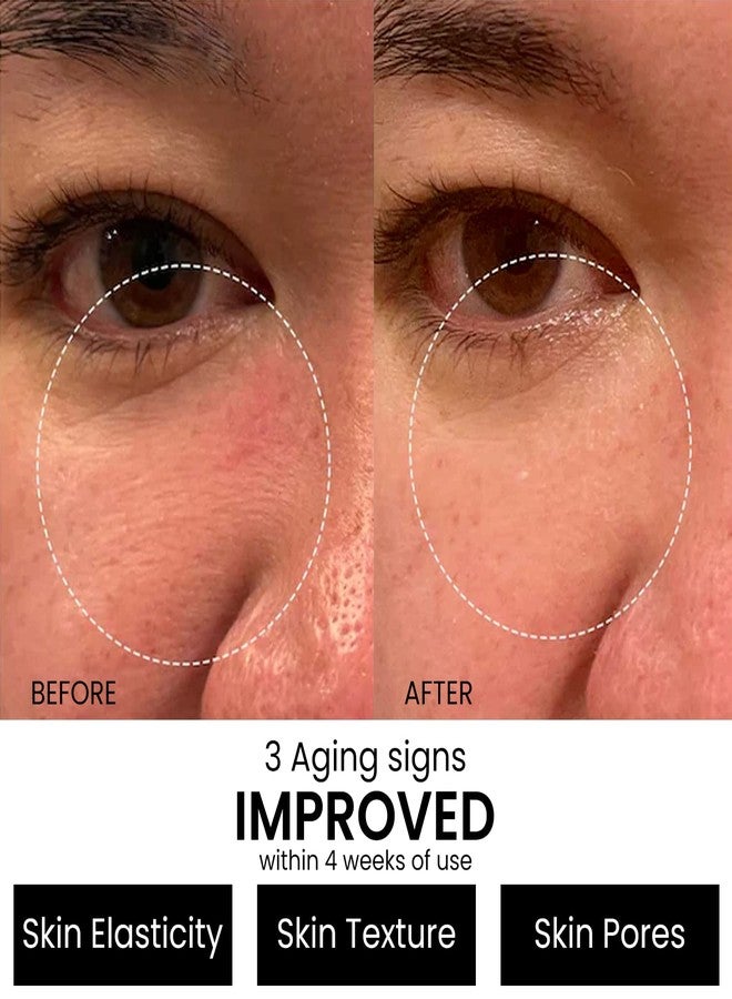 Kleem Organics Retinol Serum 2.5% for Face Anti Aging Serum with Hyaluronic Acid to Minimize Wrinkles. Improves Sun Damaged Skin and Fades Dark Spots - Vitamin A Serum - Dermatologist Tested & MADE in USA - Image 2