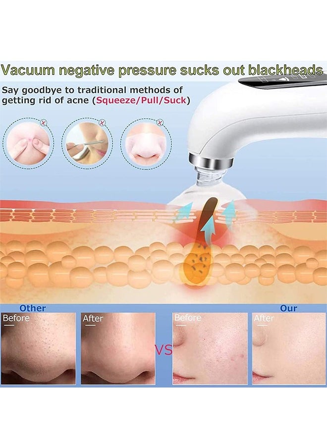 Super Micro Bubblebeauty Instrument, Blackhead Remover Pore Vacuum Cleaner, Comedo Removal Suction Beauty Device, Facial Pore Cleaner with 6 Suction Powers, for Deep Cleansing and Exfoliation - https://f.nooncdn.com/p/pzsku/ZBFBA87B0F4A03C6BC0AFZ/45/_/1724982599/df233c13-08a8-4e13-9b00-7569930c2b43.jpg?format=jpg&width=original