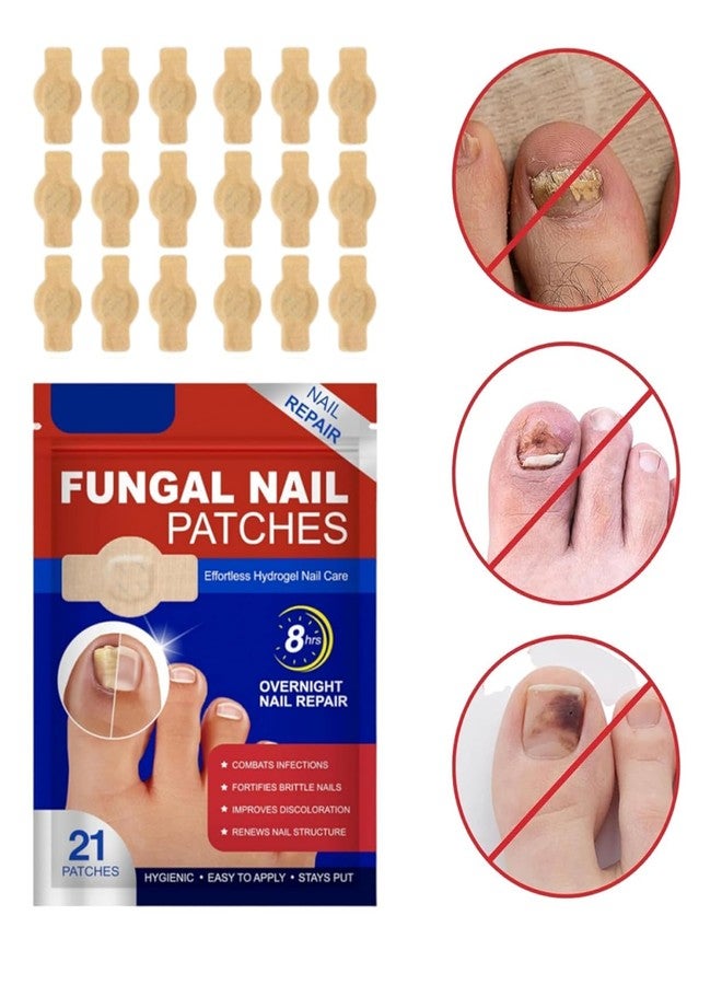 SIMESTICH 21 Pcs Nail Care Support Patches for Overnight Use | Easy Apply Nail Revitalizing Strips for Damaged Looking Nails | Comfortable, Discreet & Mess Free Nail Care Solution - Image 3