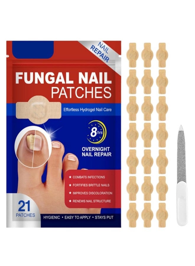 SIMESTICH 21 Pcs Nail Care Support Patches for Overnight Use | Easy Apply Nail Revitalizing Strips for Damaged Looking Nails | Comfortable, Discreet & Mess Free Nail Care Solution - Image 1