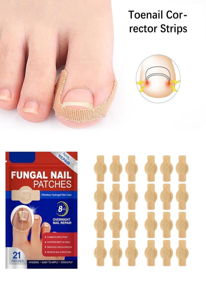 SIMESTICH 21 Pcs Nail Care Support Patches for Overnight Use | Easy Apply Nail Revitalizing Strips for Damaged Looking Nails | Comfortable, Discreet & Mess Free Nail Care Solution - Image 2