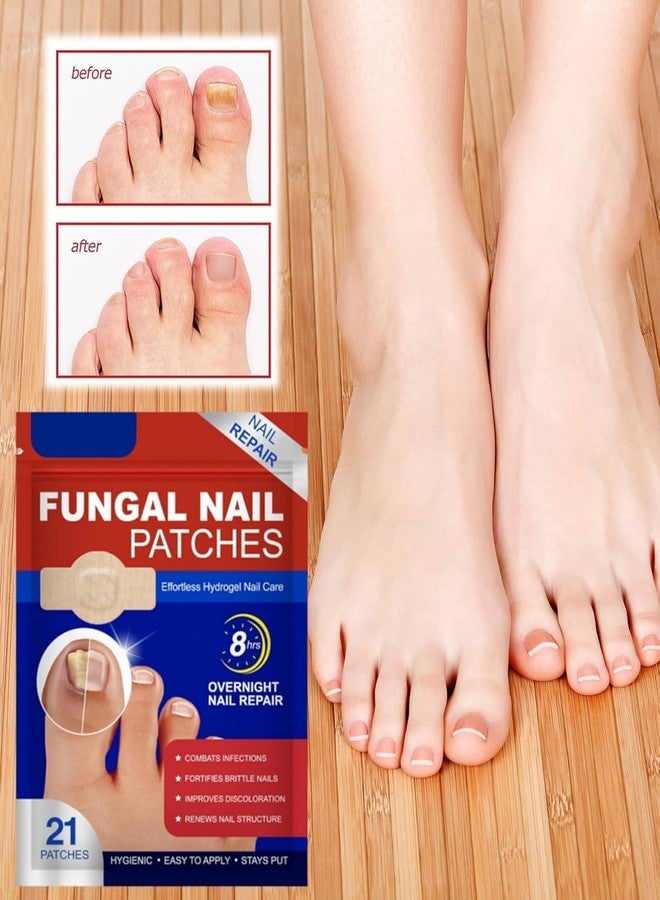SIMESTICH 21 Pcs Nail Care Support Patches for Overnight Use | Easy Apply Nail Revitalizing Strips for Damaged Looking Nails | Comfortable, Discreet & Mess Free Nail Care Solution - Image 5