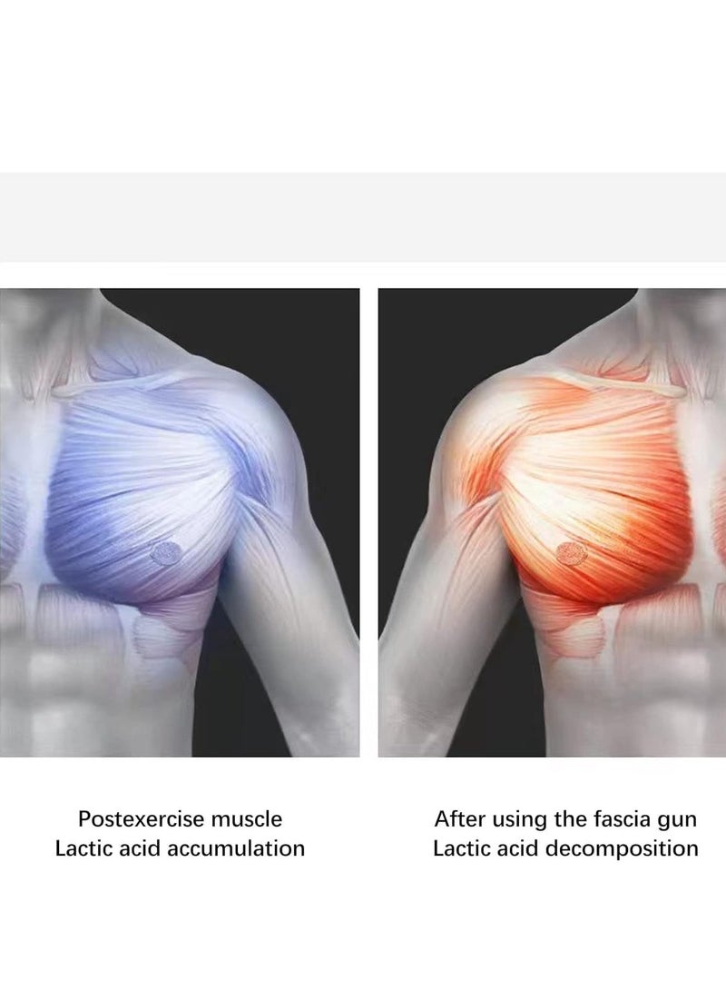 ELTRAZONE مدلك عضلات مثلثي، مدلك عضلات مثلثي كهربائي محمول 100-240 فولت 4 أوضاع 6 سرعات للأنسجة العميقة للاسترخاء (قابس الاتحاد الأوروبي) - Image 4