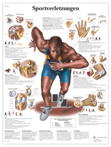 3B Scientific VR0188UU Glossy Paper Sportverletzungen Anatomical Chart (Sports Injuries Anatomical Chart, German), Poster Size 20" Width x 26" Height - Image 5