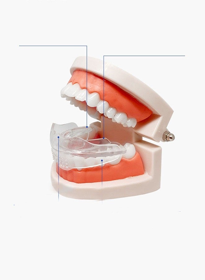 FASHION MANIA Braces aligners - Image 3
