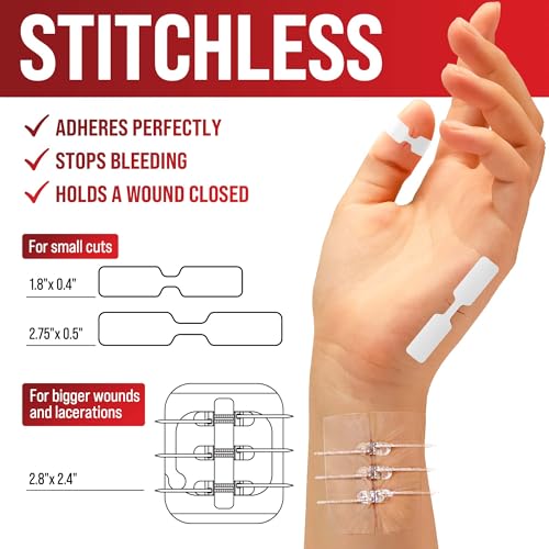 MYHELP Emergency Wound Closure Strips - 11pk - 2 Types Easy to Use Butterfly Bandages - Stitchless & Painless Laceration Closure Kit - Image 5