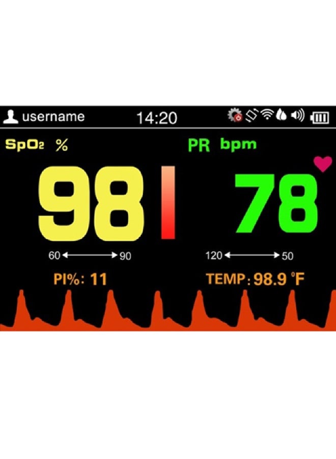 BIONEX Handheld Pulse Oximeter SP-20 for Infant | Portable Oxygen Saturation Monitor - Image 4