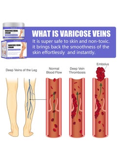 SOUTH MOON Varicose Leg Pain Vein Repair Cream  - Image 4