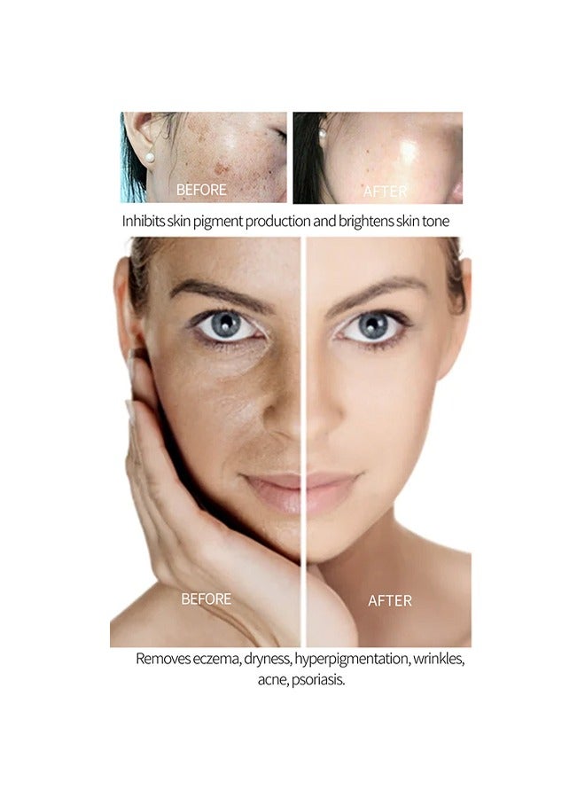 Lanthome Glutathione White Cream -Eniched with Glutathione 2%  Face Cream Whitening Moisturizing Facial Cream Face Moisturizer Facial Skin Care Cream Intensive Lightening Facial Cream 20g - Image 3