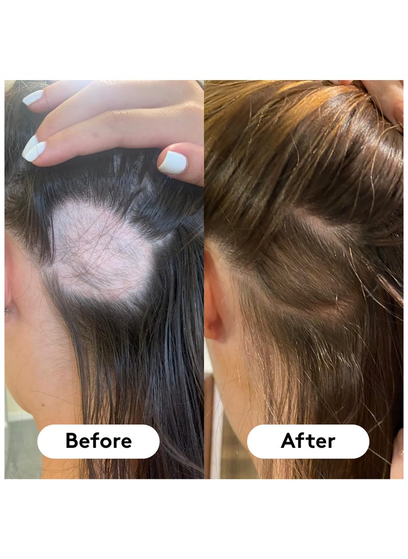 HAIR BURST - Chewable Hair Vitamins - Hair Growth Supplements For Both Men And Women - With Biotin - Anti Hair Loss - For Longer, Stronger, Thicker Looking Hair - 60 Gummies - 30 Day Supply - Image 1
