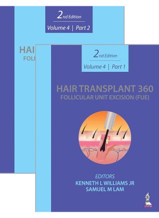 Hair Transplant 360: Follicular Unit Excision (FUE: Volume 4: Two Part Set - pzsku/ZBFE40C220B634B95C912Z/45/_/1730194975/30a915d5-e235-4bb5-a16c-3bb6472da3dc