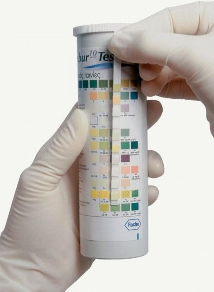 كوباس  شرائط فحص الكيتونات كمبر 10 للكشف عن الأمراض 100 قطعة - Image 3