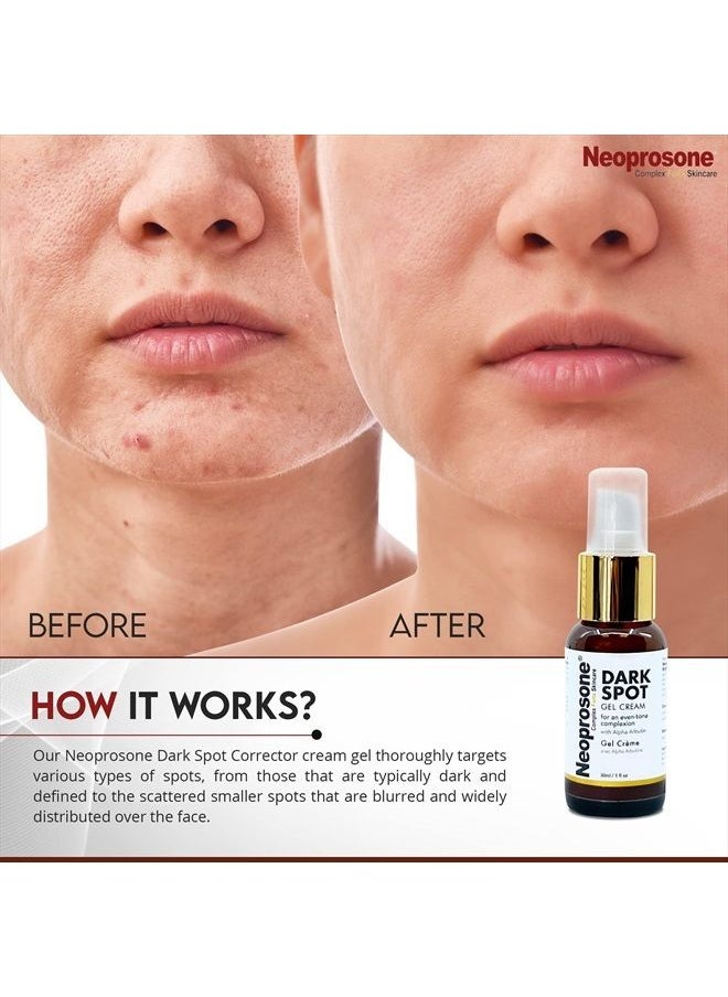 Neoprosone - , Dark Spot Remover for Face - 1 Fl oz / 30 ml - Hyperpigmentation Cream, Reduce Dark Spots, Sun Spots, Brown Spots on: Face, Knees, Elbows, Hands, Private Areas - Image 1