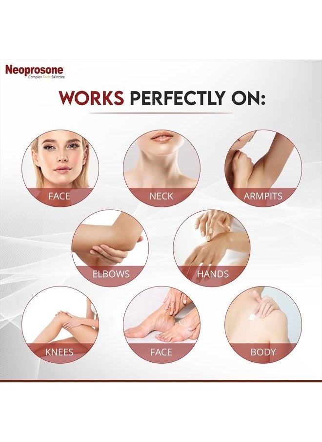 Neoprosone - , Dark Spot Remover for Face - 1 Fl oz / 30 ml - Hyperpigmentation Cream, Reduce Dark Spots, Sun Spots, Brown Spots on: Face, Knees, Elbows, Hands, Private Areas - Image 1
