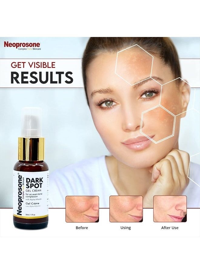 Neoprosone - , Dark Spot Remover for Face - 1 Fl oz / 30 ml - Hyperpigmentation Cream, Reduce Dark Spots, Sun Spots, Brown Spots on: Face, Knees, Elbows, Hands, Private Areas - Image 1