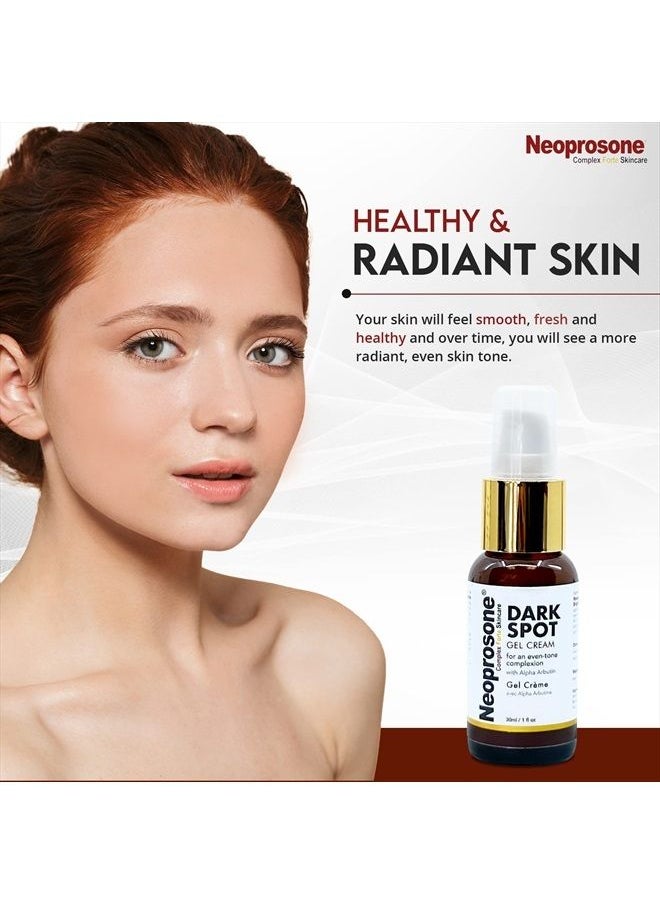 Neoprosone - , Dark Spot Remover for Face - 1 Fl oz / 30 ml - Hyperpigmentation Cream, Reduce Dark Spots, Sun Spots, Brown Spots on: Face, Knees, Elbows, Hands, Private Areas - Image 1