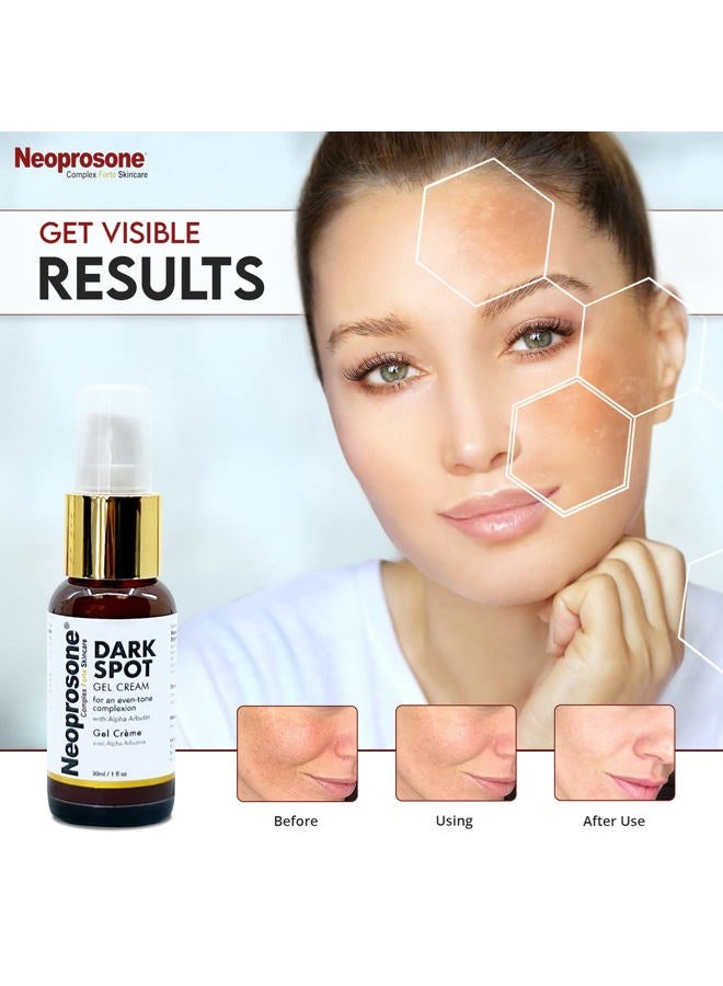 Neoprosone نيوبروسون، كريم جل للبقع الداكنة - 1 أونصة سائلة / 30 مل - كريم جل للوجه، يقلل من حب الشباب، بقع الشمس، بقع العمر على الوجه، الركب، المرفقين، اليدين، المناطق الخاصة - Image 3