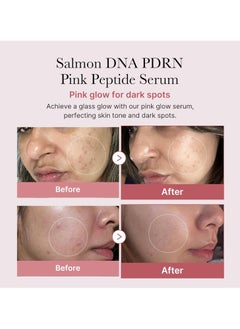 Medicube Medicube Pdrn Pink Peptide Serum, Pdrn (Sodium DNA) 1%, 5 Types Peptide Complex, Salmon DNA Pdrn Pink Peptide Serum, Pink Glow Serum for Dark Spots, 30 ml / 1.01 fl. oz.  - Image 2