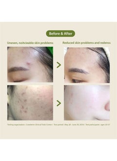 Blithe Blithe face wash,tea tree face wash Patting Splash Mask Soothing & Healing Green Tea Exfoliant - Gentle Face Exfoliator Wash for Oily Skin, Korean Skin Care Lactic Acid for Oil Controlling & Pore Clar  - Image 5