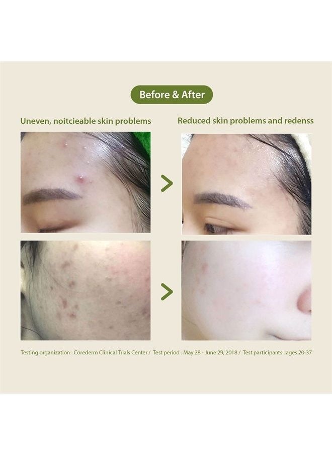 Blithe - Blithe face wash,tea tree face wash Patting Splash Mask Soothing & Healing Green Tea Exfoliant - Gentle Face Exfoliator Wash for Oily Skin, Korean Skin Care Lactic Acid for Oil Controlling & Pore Clar - Image 1