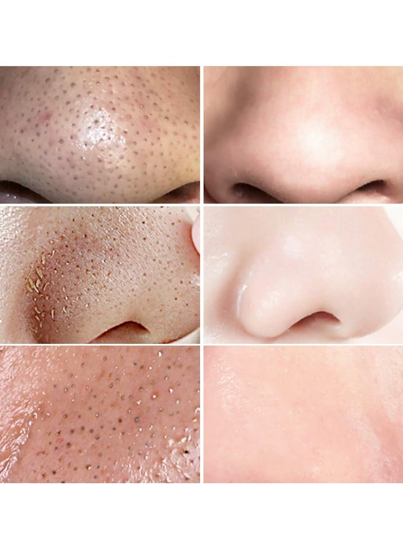LANBENA Blackhead Remover Mask, Blackhead Remover Mask Peel Off Blackhead Mask 2 in 1 Green Tea Oil Blackhead Removal 100 Pcs Blackhead Remover Mask for Pores, Nose, Chins & Face - Image 2