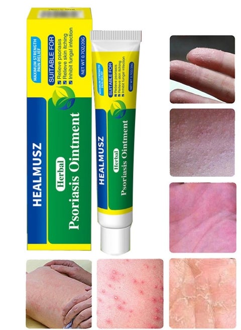 Herbal Psoriasis Ointment Advanced Psoriasis Treatment Cream Antifungal Cream Maximum Strength Pain Relief Relieve Psoriasis Skin Itching and Inhibit Fungal Infection Psoriasis Treatment Cream 20g