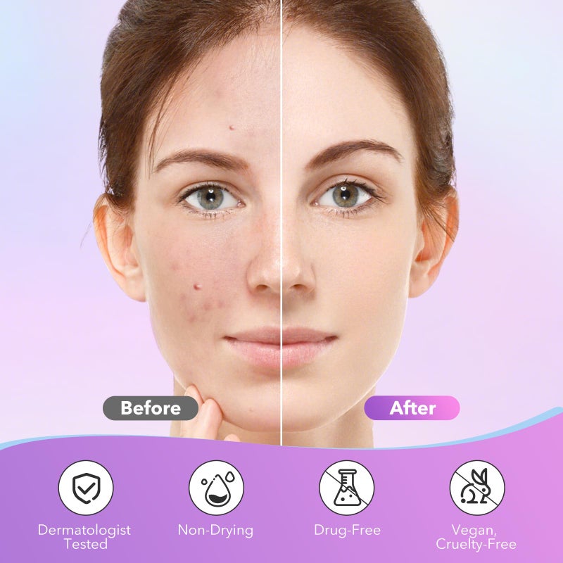 QUSTERE Pimple Patches for Face, Hydrocolloid Acne Patches, Cute Star Zit Covers for Face, Colorful Spot Stickers with Tea Tree, Salicylic Acid & Cica Oil| 3 Sizes (10mm, 12mm & 14mm) |280 Count - Image 4
