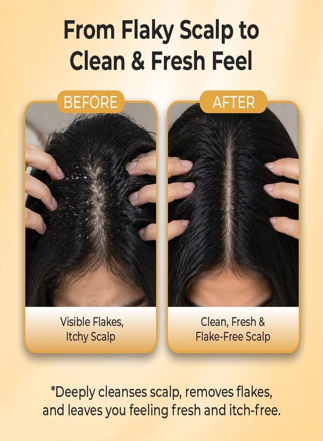 Sanfe Dandruff Care Advanced Scalp Cleaning Comb For Healthy Scalp | 1 Unit - Image 2
