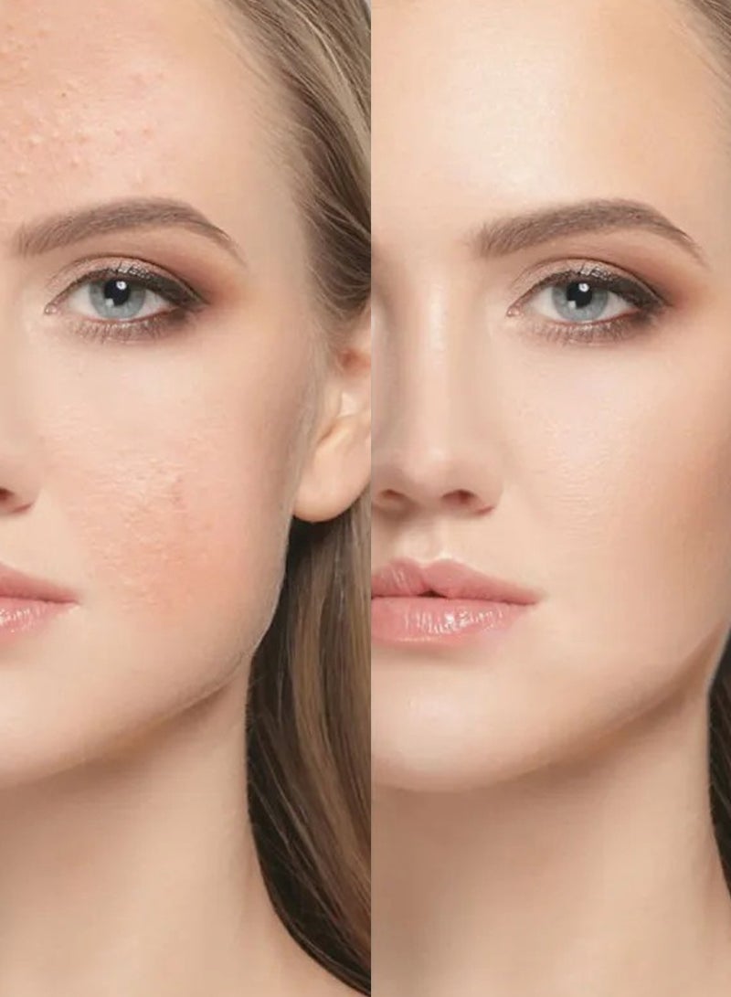 Face Fresh Set of 6 Fairness Face Serum - Alpha Arbutin & Glutathione, Brightening & Glowing Skin, Clears Dark Cells, Best for Dry Skin but can use for All Skin Types 3ml - Image 5