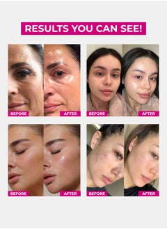 Face Fresh Set of 6 Fairness Face Serum - Alpha Arbutin & Glutathione, Brightening & Glowing Skin, Clears Dark Cells, Best for Dry Skin but can use for All Skin Types 3ml  - Image 2