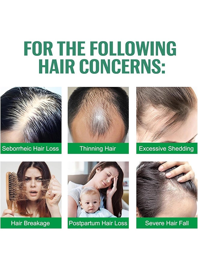 HOEGOA Hair Care Spray ,Natural Hair Loss Treatments for Women Men Promotes Regrowth Reduces Loss Thinning Strengthen Scalp Nourishes Dry ,100ml - Image 2