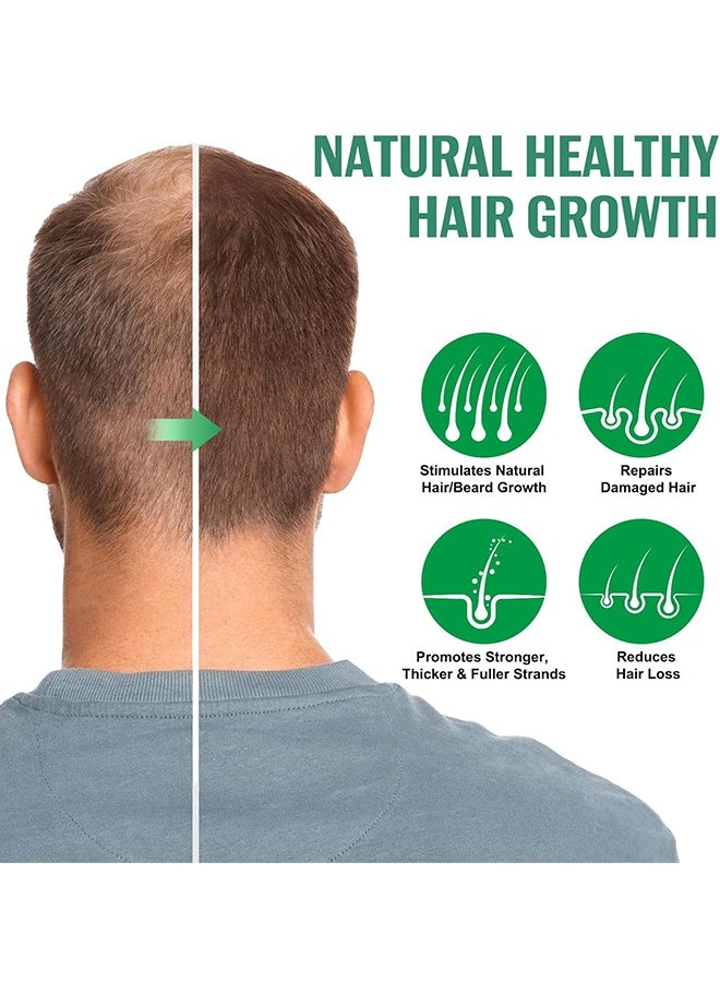 HOEGOA Hair Care Spray ,Natural Hair Loss Treatments for Women Men Promotes Regrowth Reduces Loss Thinning Strengthen Scalp Nourishes Dry ,100ml - Image 4