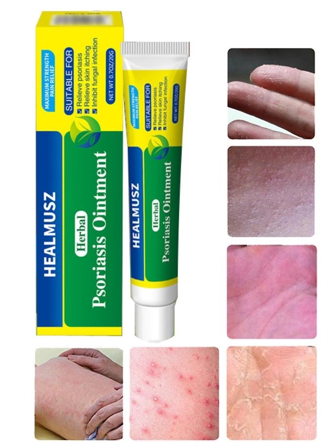HEALMUSZ - Herbal Psoriasis Ointment Advanced Psoriasis Treatment Cream Antifungal Cream Maximum Strength Pain Relief Relieve Psoriasis Skin Itching and Inhibit Fungal Infection Psoriasis Treatment Cream 20g - Image 1