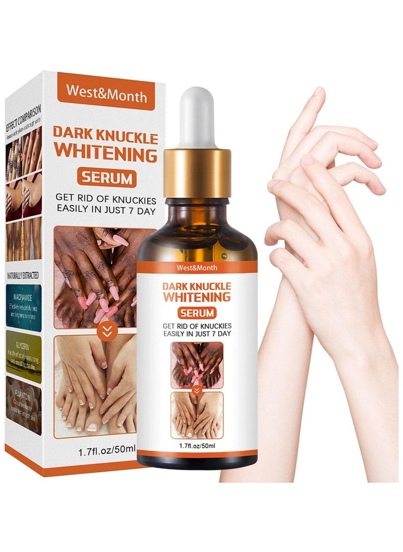 West&Month Dark knuckle Whitening Serum,7 days Treatment for Dark Spots in Hand and Feet Knuckles Exfoliating Improves Dullness Powerful Whitening Effect for Men and Women 50ml  - Image 1