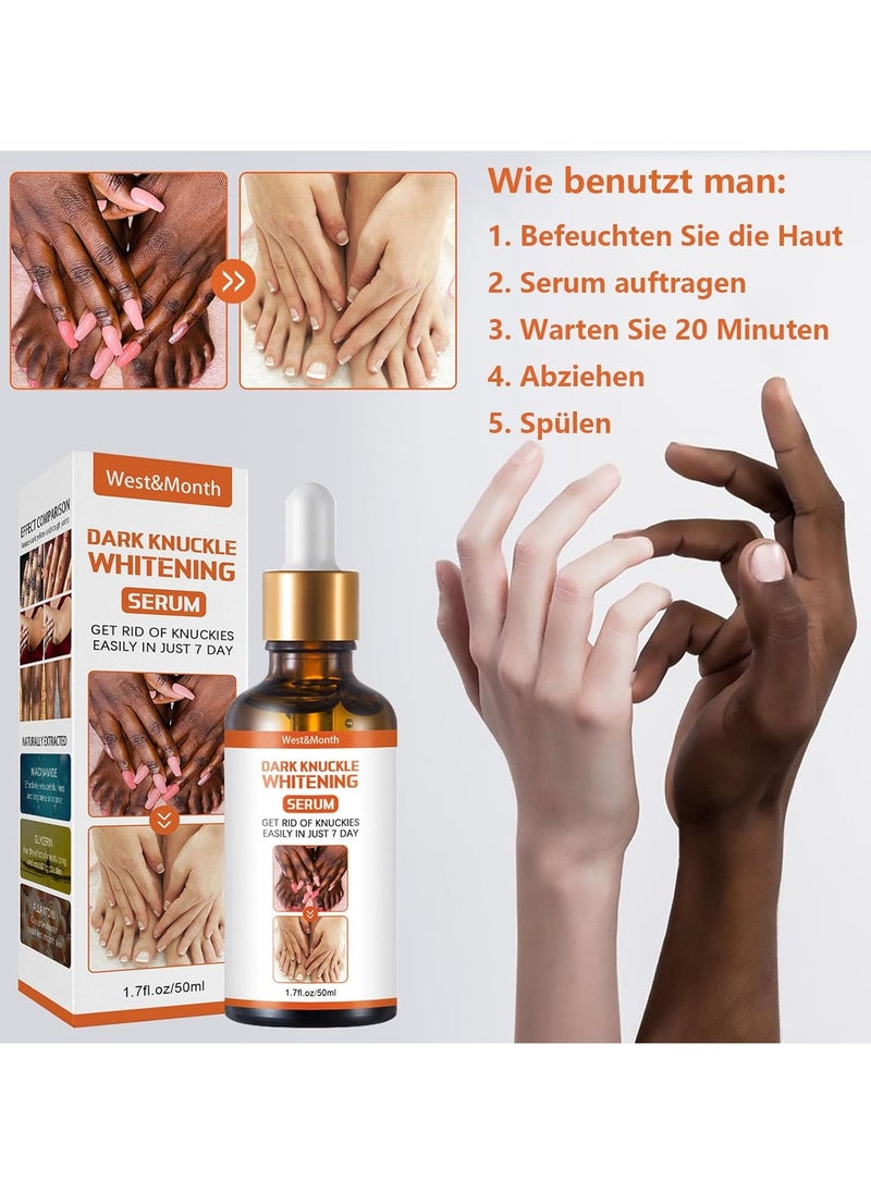 West&Month Dark knuckle Whitening Serum,7 days Treatment for Dark Spots in Hand and Feet Knuckles Exfoliating Improves Dullness Powerful Whitening Effect for Men and Women 50ml  - Image 4