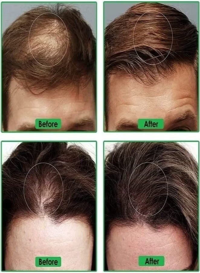 FEG Plus Thicker Hair Growth Spray – Fast-Acting Formula for Fuller Hair – 50 ml - Image 2
