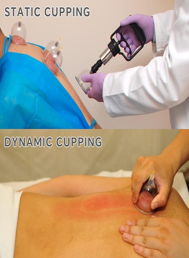 click2shop Premium Cupping Therapy Kit with Pump 12-Piece Hijama Set for Full Body Massage, Pain Relaxation for Body, Pain Relief Vaccum Cups, Chinese Therapy Cupping for Physiotherapy - Image 3