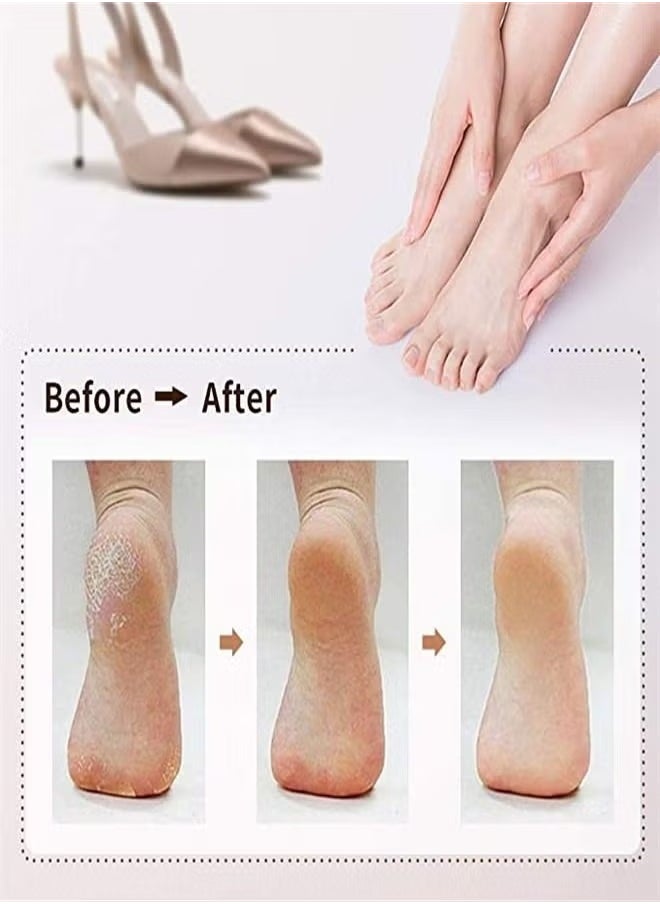 Generic - Electric Foot File Callus Remover Rechargeable Pedicure Tools Professional Foot Scraper With 3 Roller Heads 2 Speed Smart Light and Digital Display for Removing Dead Skin and Calluses - Image 1