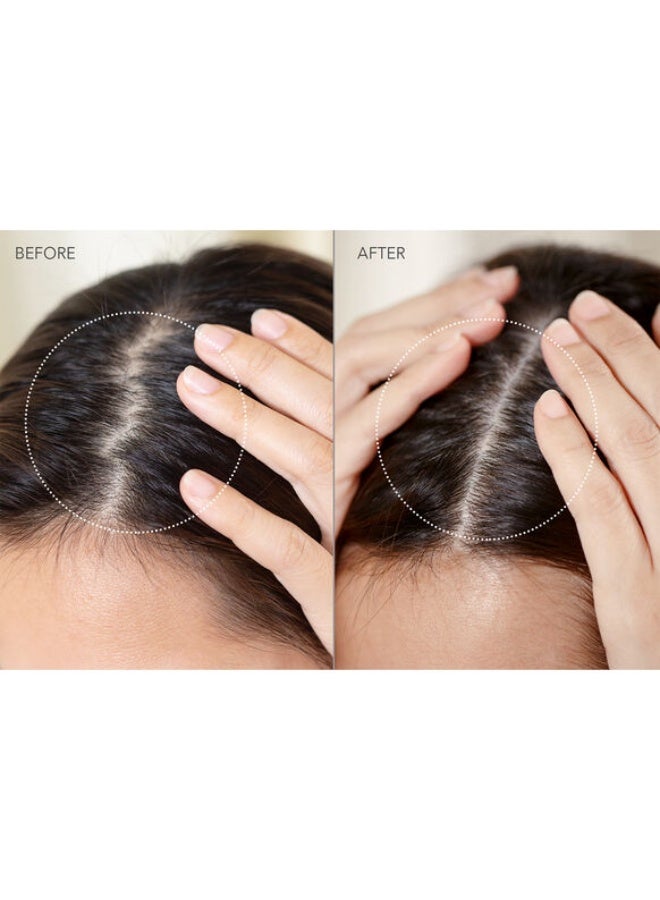 Foreo Luna™ 4 Hair - Image 4