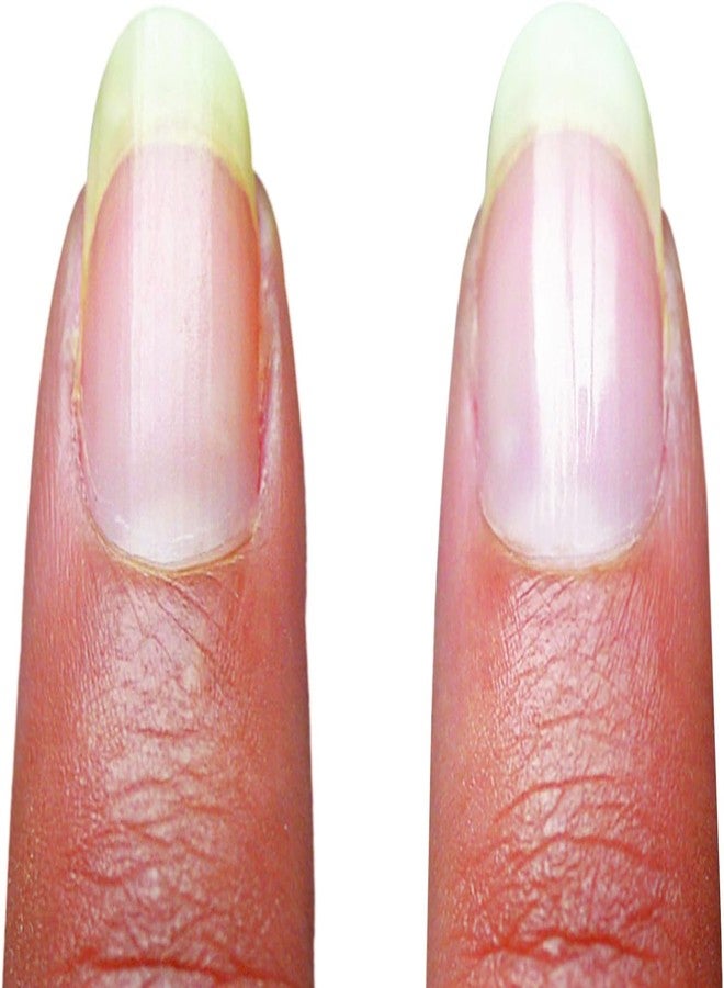 Emjoi Micro Nail Manicure or Mani Pedi--Smooths, Buffs & Shines Instantly - Image 5