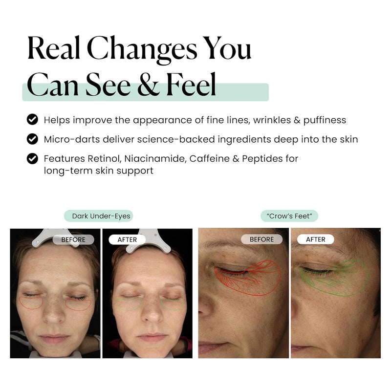 Qure Skincare MicroInfusion Targeted Patches 8 Pairs of Targeted Under Eye Patches Formulated for Fine Lines Wrinkles Retinol Caffeine Niacinamide Peptides Dissolvable for Overnight Use - Image 5