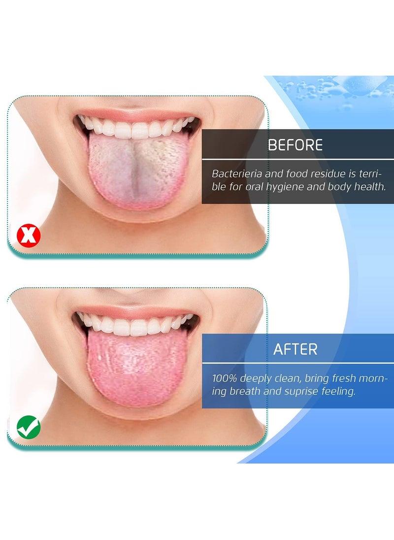 SYOSI Tongue Scraper 4PCS Stainless Steel Tongue Cleaners 100% BPA Free Fresher Tongue Tools Healthy Oral Hygiene Brushes Medical Grade Reusable Stainless Steel Eliminate Bad Breath  - Image 3