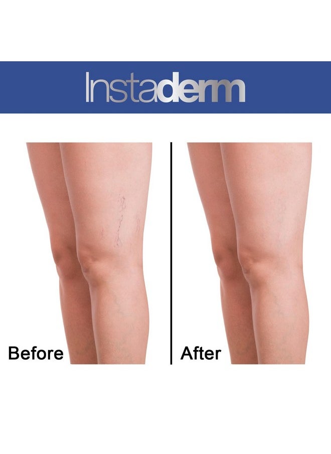 Instaderm - Vitamin K Cream Bruise Healing Formula With Arnica. Dark Spot Moisturizer For Bruising Spider Veins & Broken Capillaries. Repair Under Eye Dark Circles & Puffiness. - Image 1