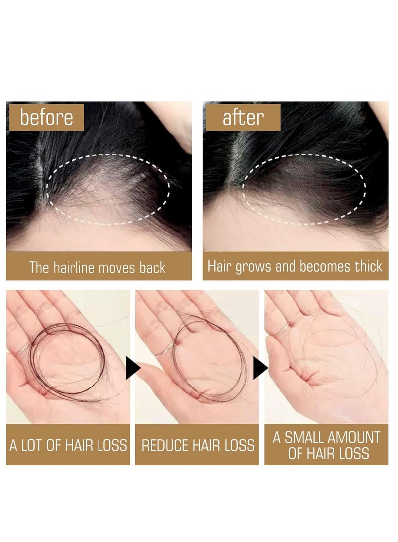 2 PCS Remimpi Anti Hair Loss Shampoo - Routine Shampoo for Women Hair Loss, Rich in Various Plant Extracts, Anti-Hair Fall Promote Hair Growth (300ml*2) - Image 5