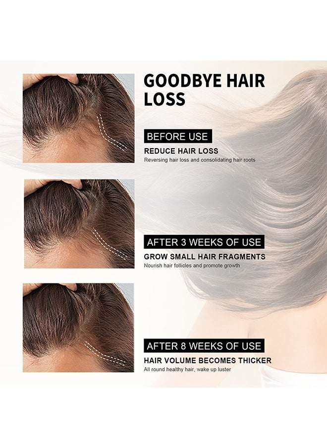 Jaysuing - Hair Loss Treatment Serum-Rosemary Tea Tree Oil Infused with Biotin, Nourishes and Moisturizes Hair, Dry Damaged Hair, Promotes Hair Growth & Scalp Health 60ml - Image 1